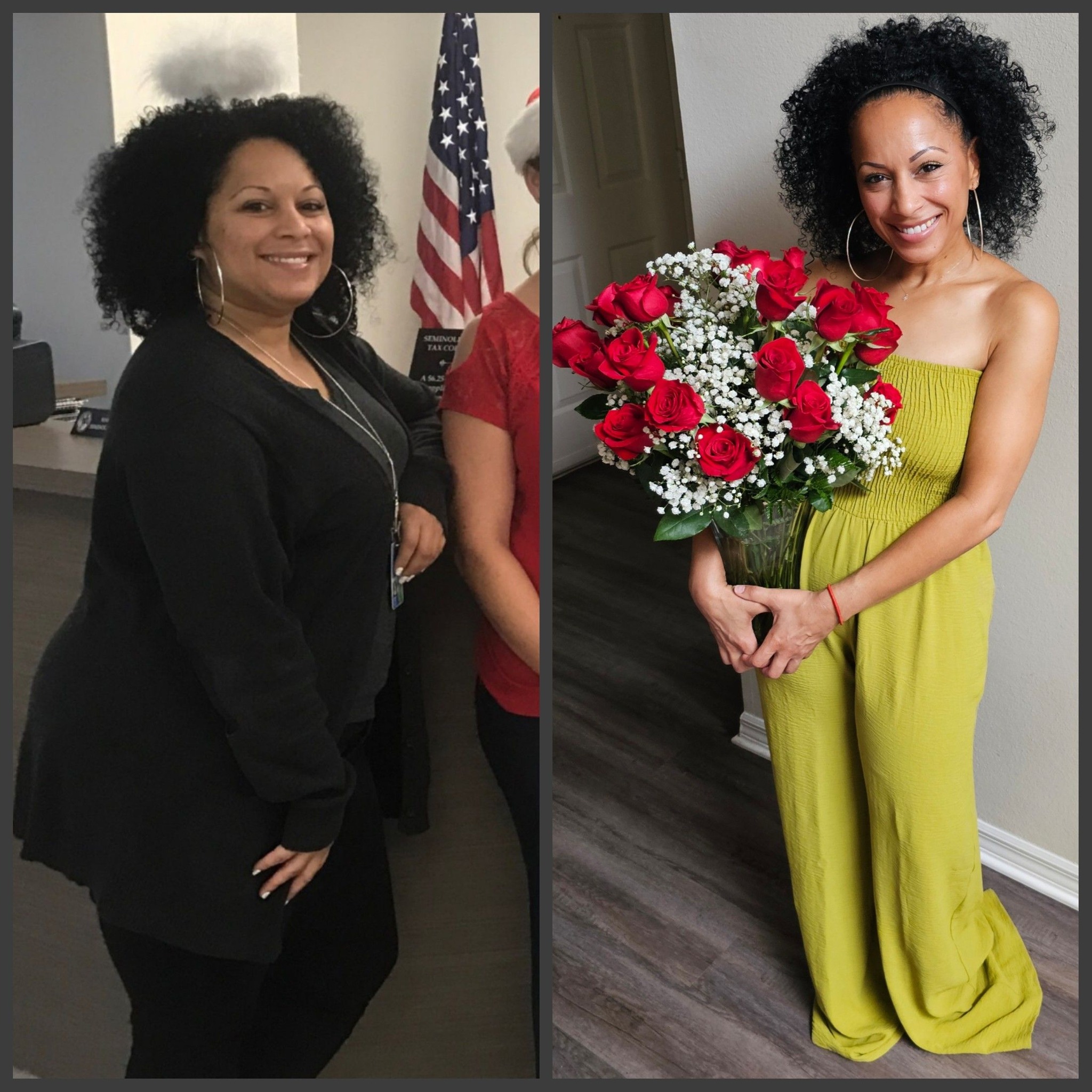 Nathalie Before and After Gastric Sleeve