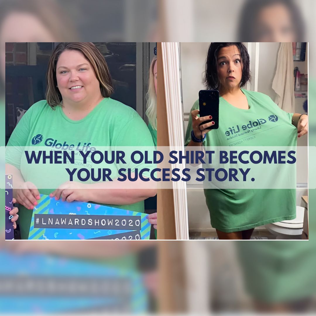Before and after gastric sleeve surgery in Mexico — significant weight loss results