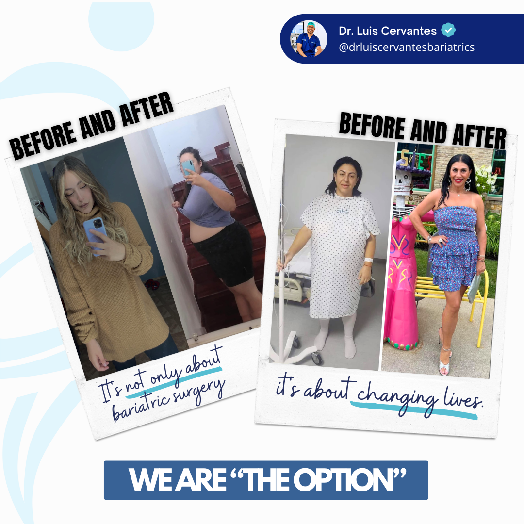 Significant weight loss results from bariatric surgery in Mexico