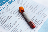 Preoperative laboratory testing before bariatric surgery